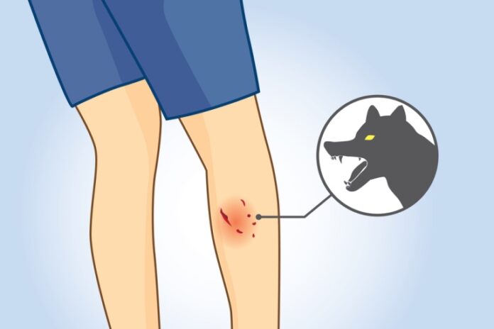 exploring the multifaceted impact of dog bites